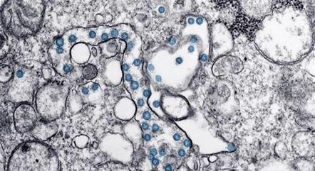 efe-virus-coronavirus-laboratorio-microscopio-900-15022021082705281 Cientistas criam material capaz de eliminar coronavírus de superfícies