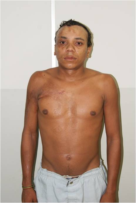 Gilson Nicolau dos Santos (Vulgo Nêgo) 26 anos