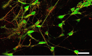 Neurônios-dopaminérgicos-copy