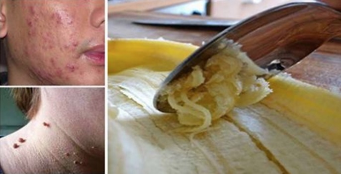 beneficios-da-casaca-da-banana