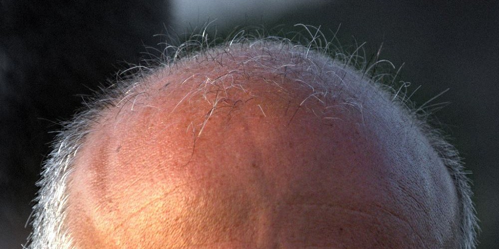 careca-1000x500
