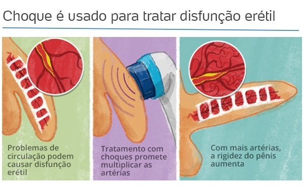 disfuncao-1463607040823_600x377