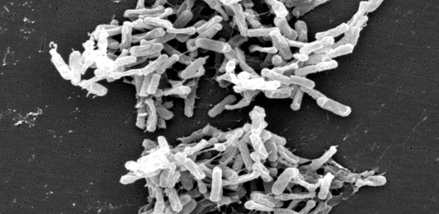 micrografia-eletronica-de-varredura-mostra-a-bacteria-clostridium-difficile-1469580545287_615x300